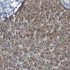 Anti-SVOPL Antibody