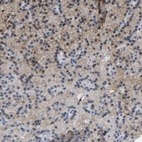 Anti-ZNF449 Antibody