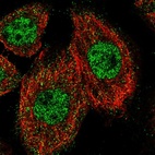 Immunofluorescent staining of human cell line A-431 shows localization to nucleoplasm & cytosol.