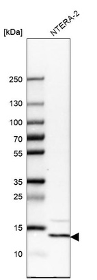 Anti-YBEY Antibody