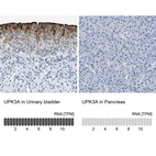 Anti-UPK3A Antibody