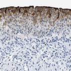 Anti-UPK3A Antibody