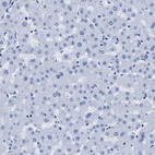 Anti-UPK3A Antibody