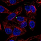 Anti-SLC39A5 Antibody