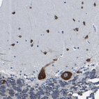 Anti-G3BP2 Antibody