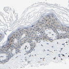 Anti-G3BP2 Antibody