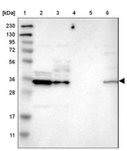 Lane 1: Marker [kDa] 230, 130, 95, 72, 56, 36, 28, 17, 11_br/_Lane 2: Human cell line RT-4_br/_Lane 3: Human cell line U-251MG sp_br/_Lane 4: Human plasma (IgG/HSA depleted)_br/_Lane 5: Human liver tissue_br/_Lane 6: Human tonsil tissue