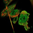 Immunofluorescent staining of human cell line U-251 MG shows localization to nucleoplasm & cytosol.