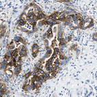 Anti-CLDN18 Antibody