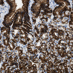 Anti-CLDN18 Antibody