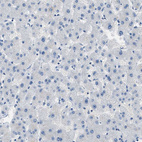 Anti-CLDN18 Antibody