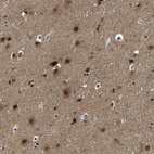 Anti-PPM1E Antibody