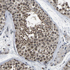 Immunohistochemical staining of human testis shows moderate nuclear positivity in cells in seminiferous ducts.