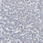 Anti-PPM1E Antibody