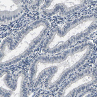 Immunohistochemical staining of human endometrium shows no positivity in glandular cells as expected.