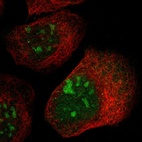 Immunofluorescent staining of human cell line A-431 shows localization to nucleus & nucleoli.