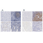 Anti-LRMP Antibody