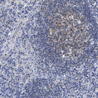 Anti-LRMP Antibody