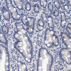 Anti-LRMP Antibody