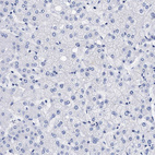 Anti-LRMP Antibody