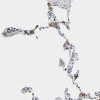 Anti-EVL Antibody