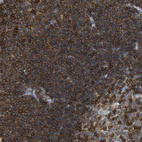 Anti-EVL Antibody