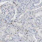 Anti-EVL Antibody