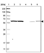 Anti-YARS Antibody