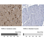 Anti-YARS Antibody