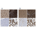 Anti-YARS Antibody