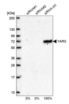 Anti-YARS Antibody