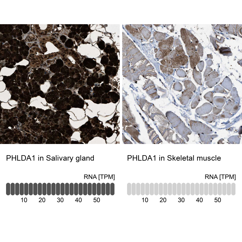 Anti-PHLDA1 Antibody