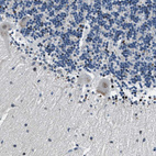 Anti-PHLDA1 Antibody