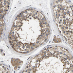 Anti-AIMP2 Antibody