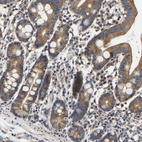 Anti-AIMP2 Antibody