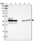 Anti-AIMP2 Antibody