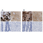 Anti-HAPLN1 Antibody