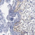 Anti-HAPLN1 Antibody