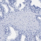 Anti-HAPLN1 Antibody