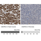 Anti-UQCRC2 Antibody