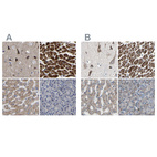 Immunohistochemical staining of human cerebral cortex, heart muscle, liver and pancreas using Anti-UQCRC2 antibody HPA019146 (A) shows similar protein distribution across tissues to independent antibody HPA007998 (B).