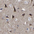 Anti-UQCRC2 Antibody