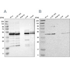 Western blot analysis using Anti-UQCRC2 antibody HPA019146 (A) shows similar pattern to independent antibody HPA007998 (B).