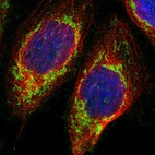 Immunofluorescent staining of human cell line A-431 shows localization to mitochondria.