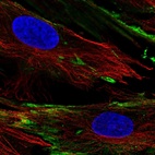 Anti-PXDC1 Antibody