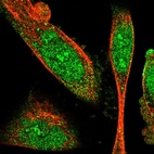 Anti-SNX30 Antibody