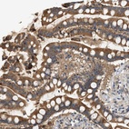 Anti-WDR31 Antibody