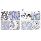 Anti-HEMGN Antibody