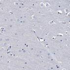 Anti-HEMGN Antibody