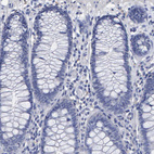 Anti-HEMGN Antibody